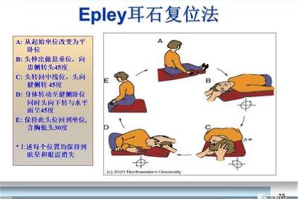 耳石复位方法