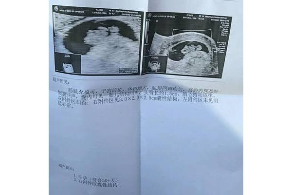 孕8周胎儿真实图