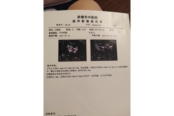 孕8周胎儿真实图