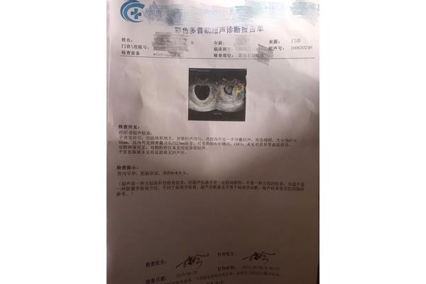 孕8周胎儿真实图