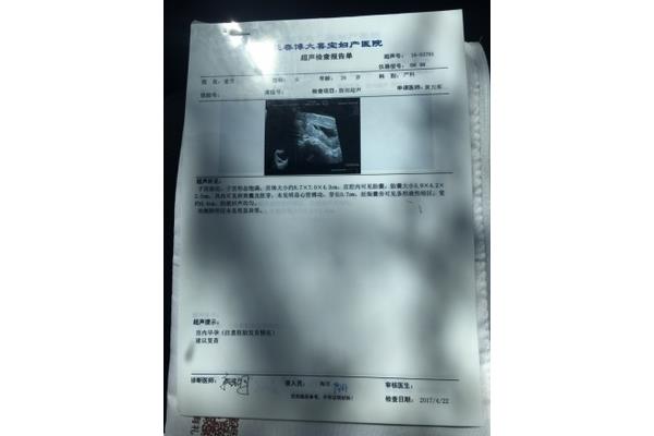 孕8周胎儿真实图