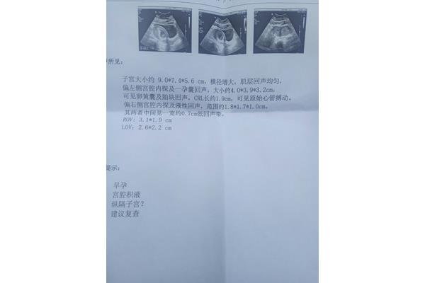 孕8周胎儿真实图