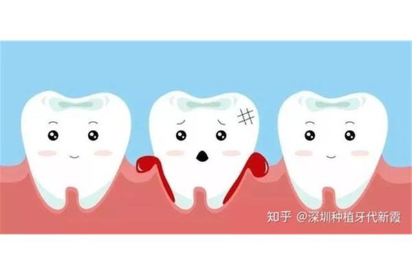 牙齿松动疼痛
