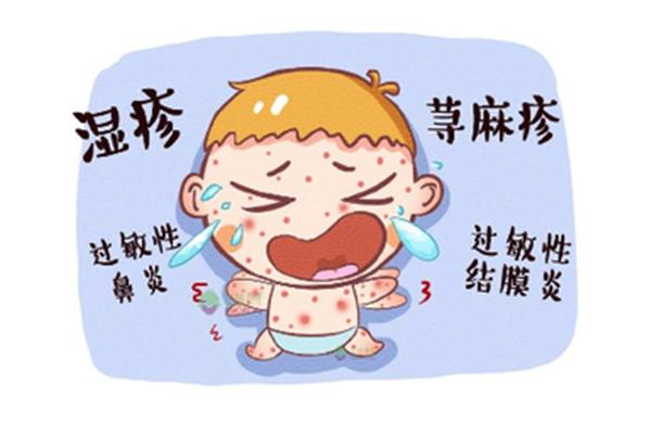 食物过敏症状