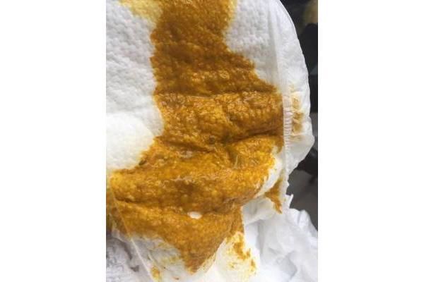婴儿大便有粘液