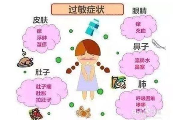 食物过敏症状