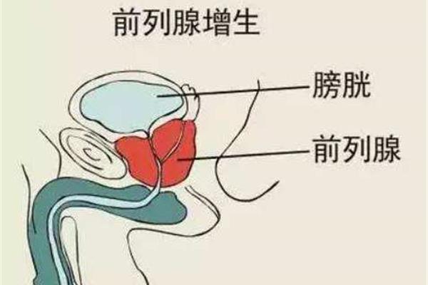 回声是怎么形成的