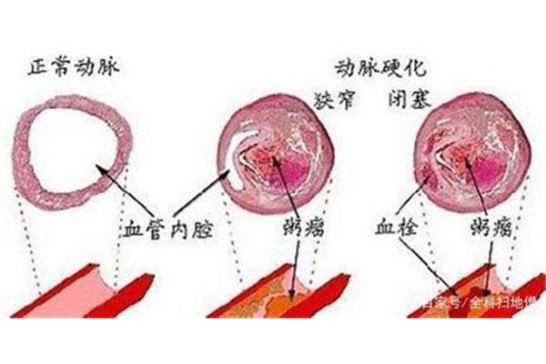 回声是怎么形成的