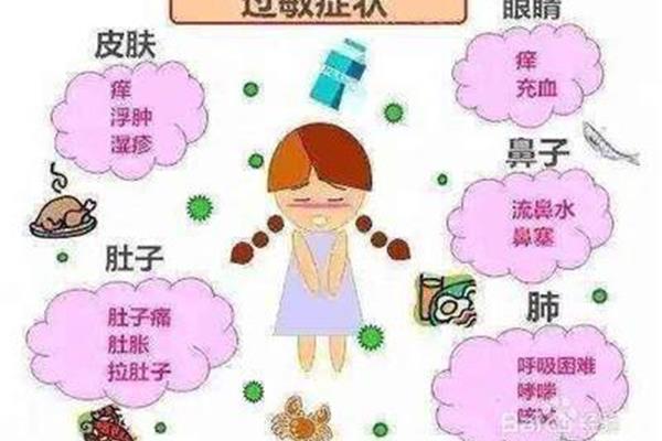 食物过敏症状