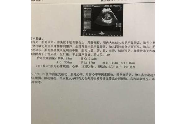 6斤有多重