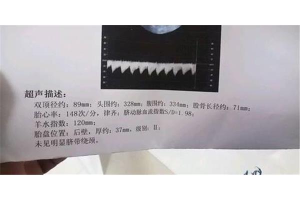 6斤有多重