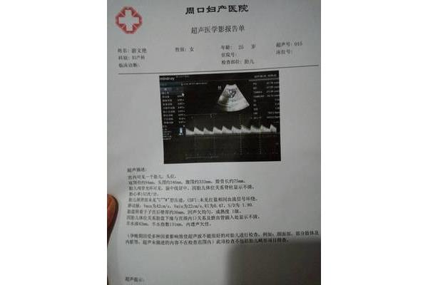 6斤有多重