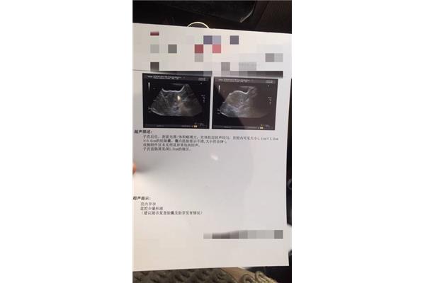 怀孕几周才有胎心