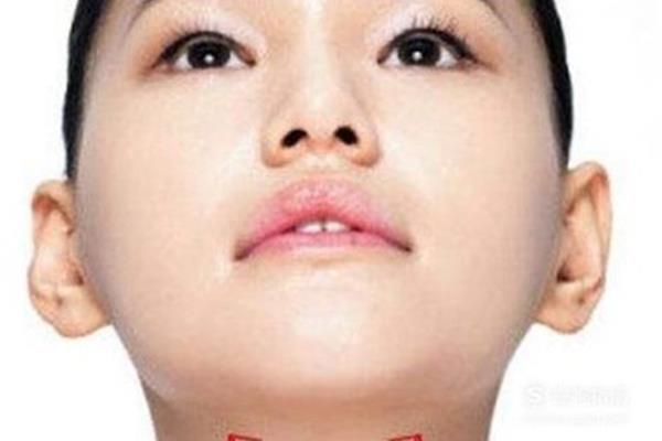 双下巴怎么减