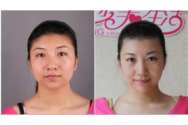 双下巴怎么减