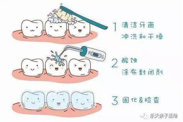如何预防龋齿