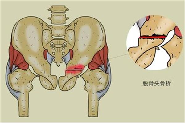 脊椎错位怎么治疗