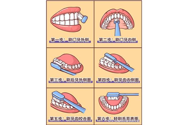 如何预防龋齿