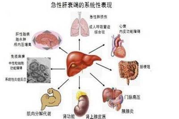 多器官功能衰竭