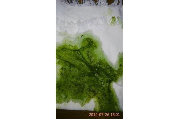婴儿绿色大便