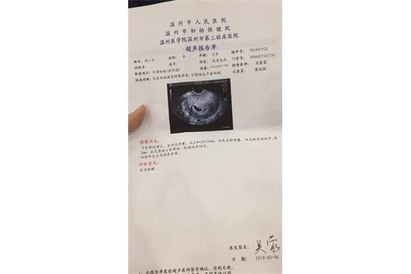 卵黄囊是什么意思