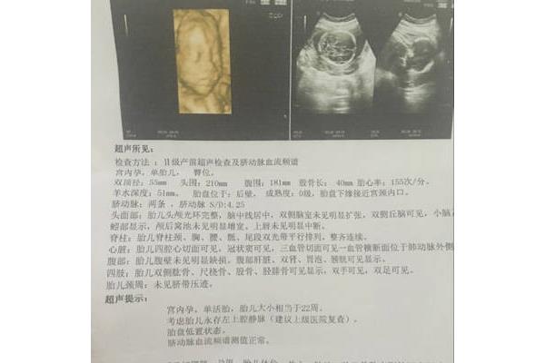五个月胎儿