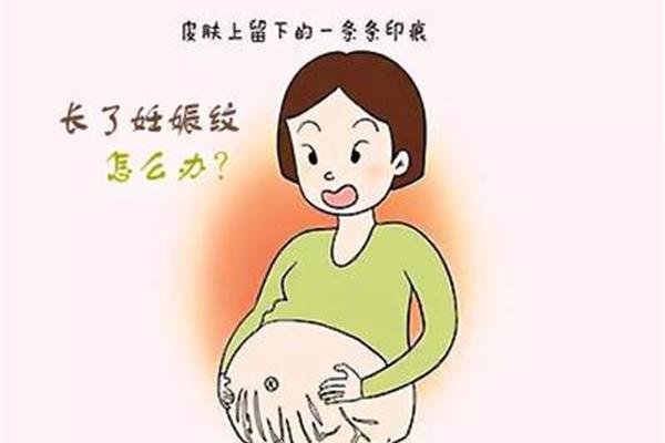 如何预防妊娠纹