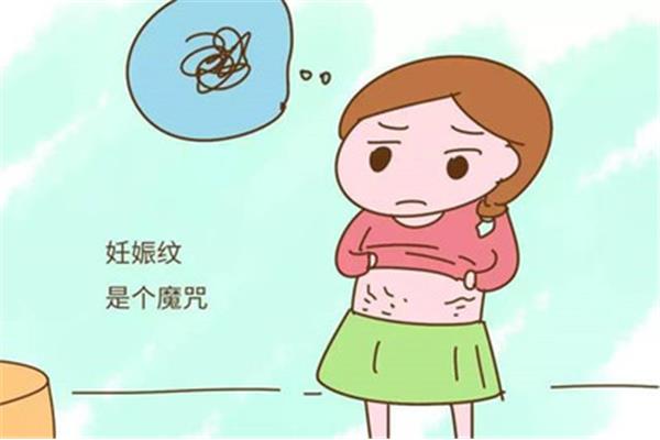 如何预防妊娠纹
