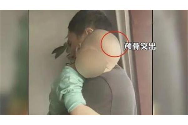 佝偻怎么读