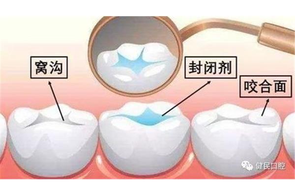 咀嚼是什么意思