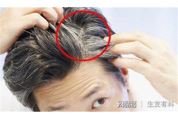 染发的危害