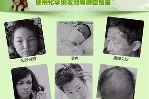 染发的危害