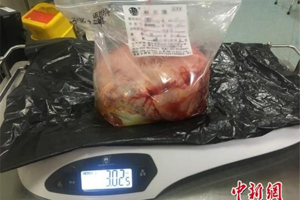 正常多大