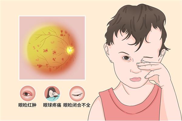 儿童眼皮红肿