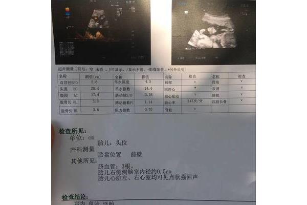 什么是排畸检查