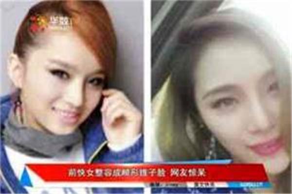什么脸型越瘦越丑