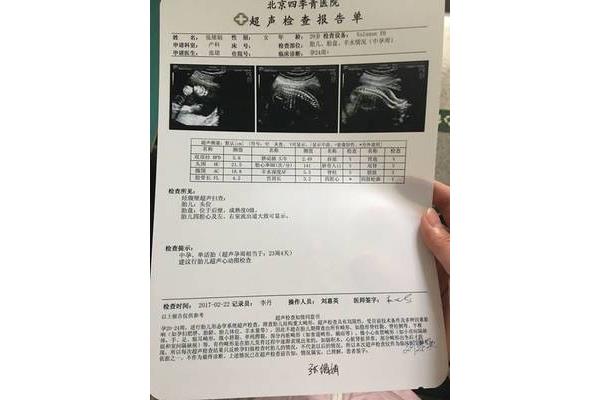 什么是排畸检查