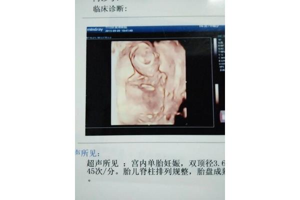 5个月的胎儿
