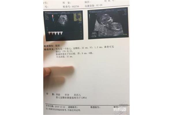 查b超需要空腹吗