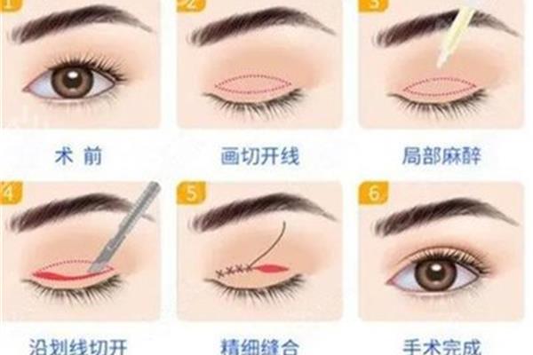 怎么形容眼睛