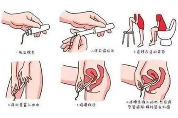 卫生怎么使用